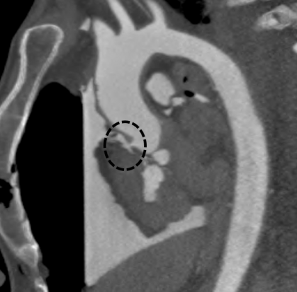 Imagerie médicale