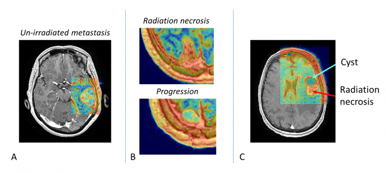 Imagerie médicale