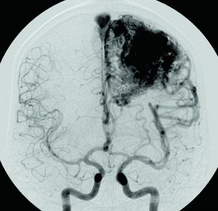 Imagerie médicale