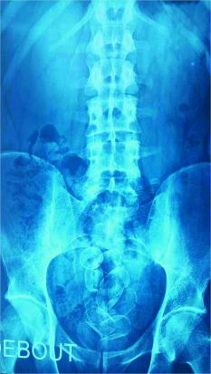 Imagerie médicale
