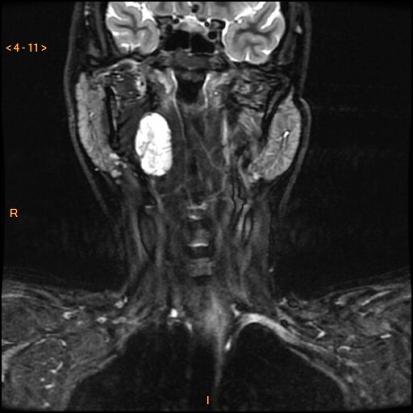 fig_1