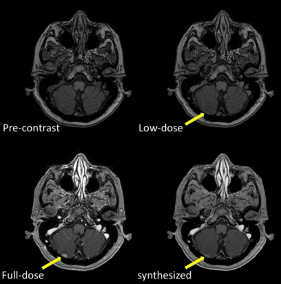 fig1