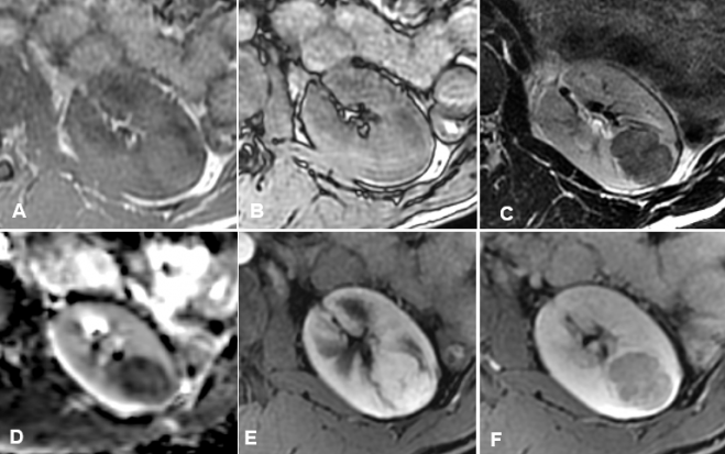 fig1