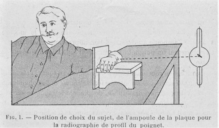 radiographie dans les traumatismes du poignet