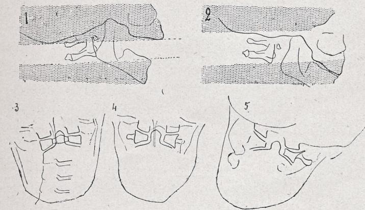 Schéma de la direction du faisceau