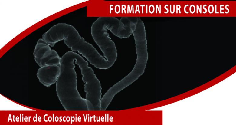 Scanner colon