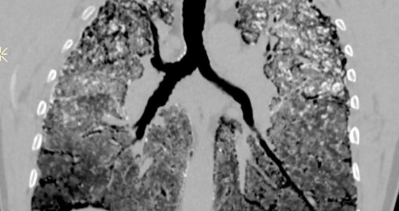cas_5_fig_5