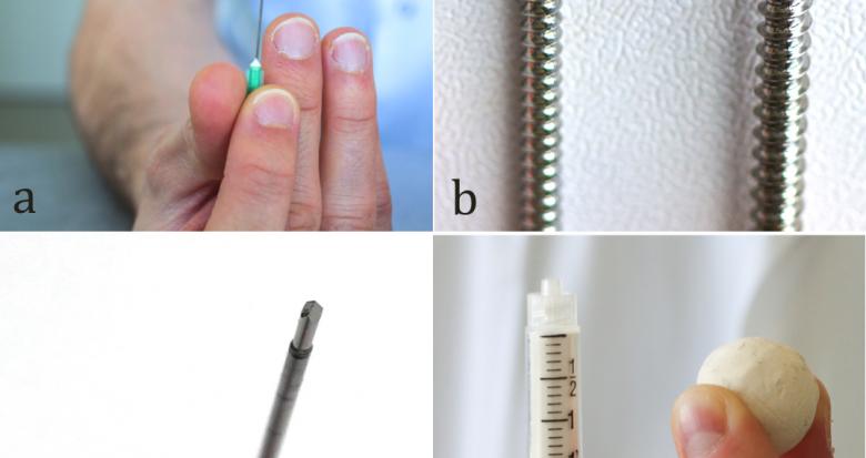 Voici un petit panel de la « boîte à outils » du radiologue interventionnel en musculosquelettique.