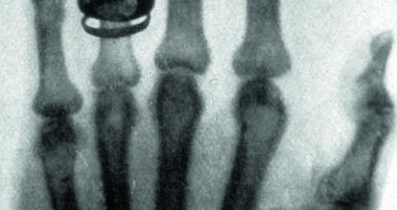 Imagerie médicale
