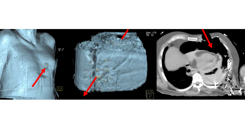 le role du manipulateur en imagerie forensique sfr e bulletin