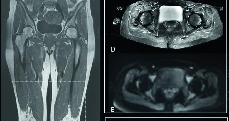 Imagerie médicale