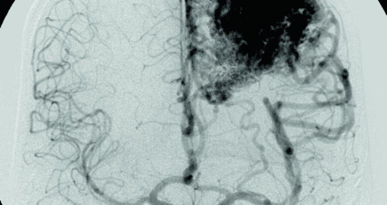 Imagerie médicale