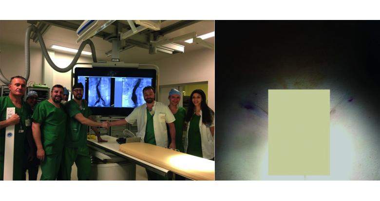Rodiologie interventionnelle et aorte