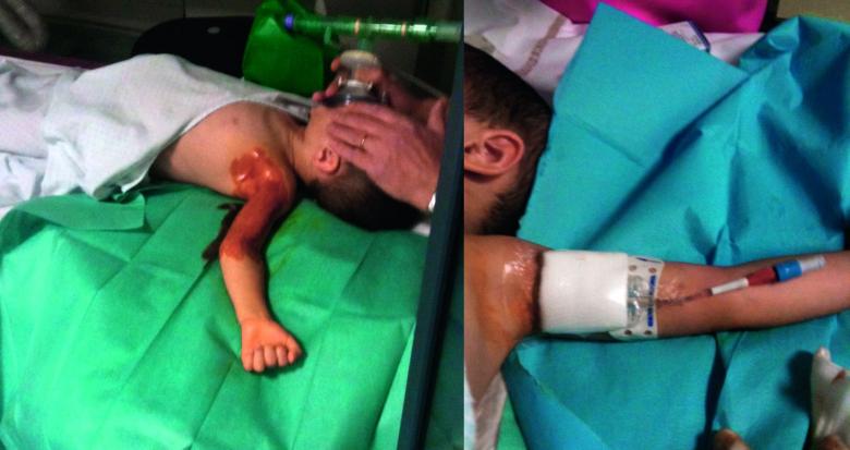 Enfant Radiologie
