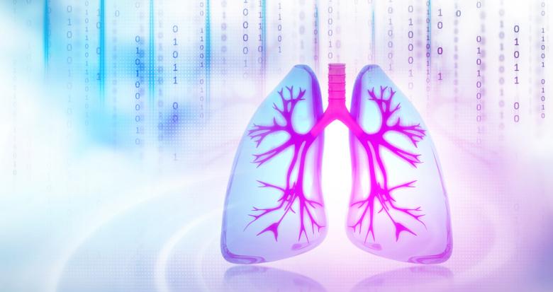 Cancer bronchique