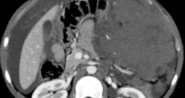 fig_1