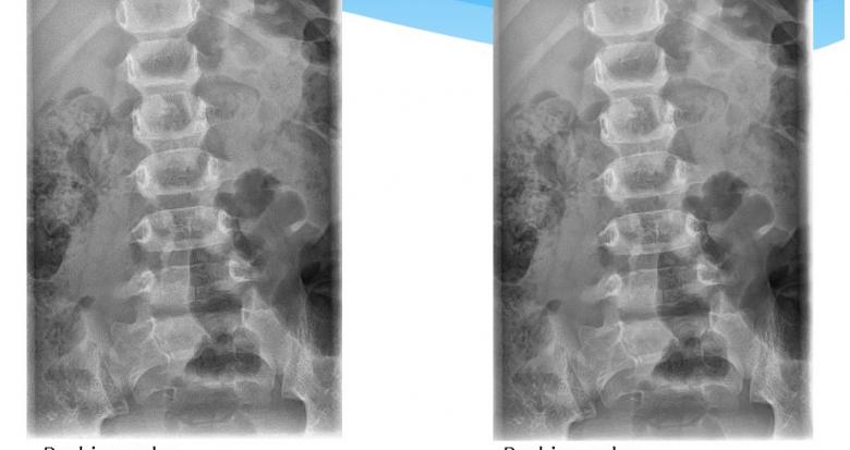 En Route Vers Alada Un Effort Collaboratif Radiologues Et Physiciens Sfr E Bulletin