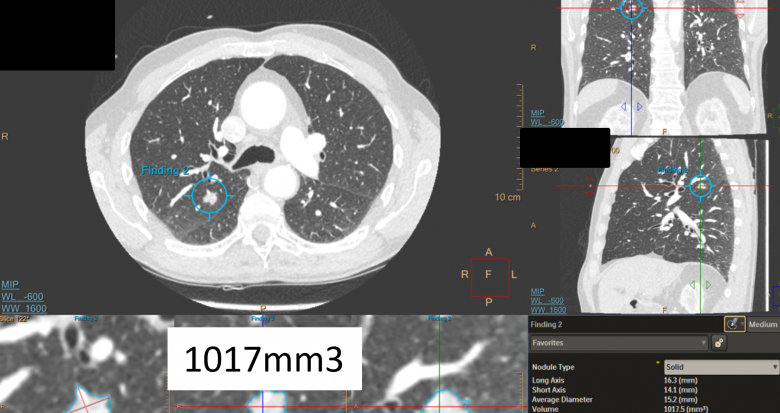 fig_1