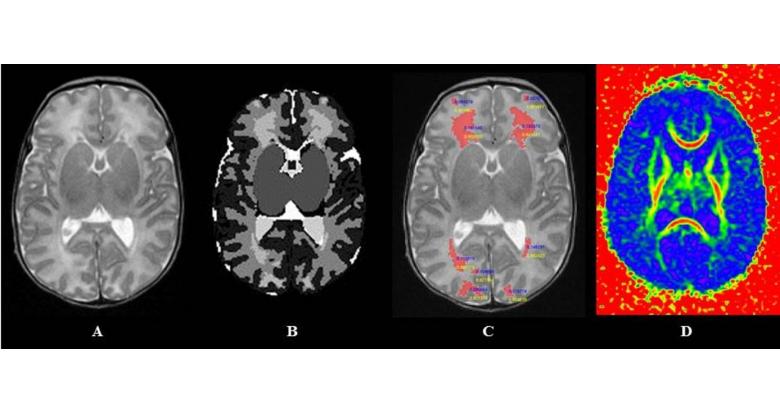 fig_1