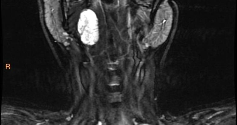 fig_1