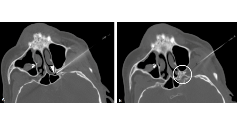 fig_1