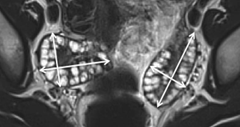 fig_1