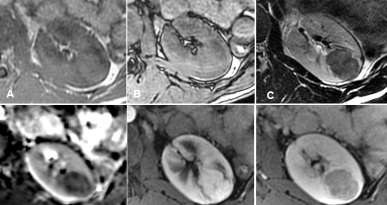 fig_1