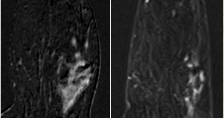 fig_1