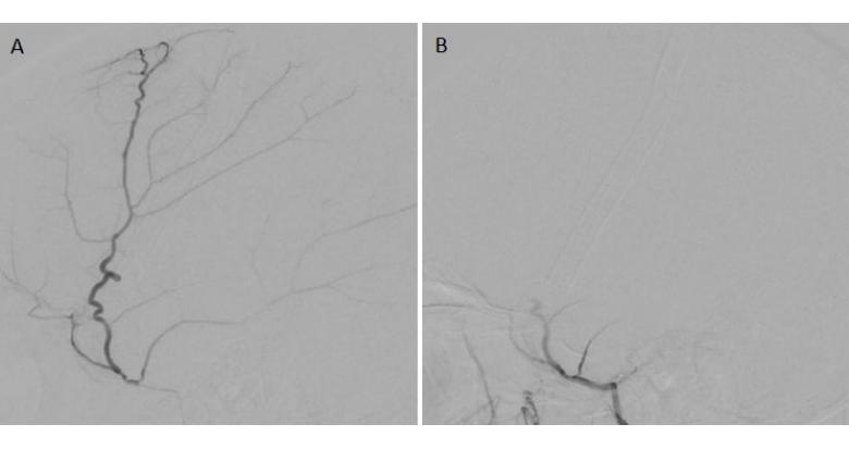 fig_1