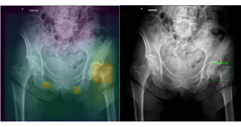 ia_imagerie_medicale