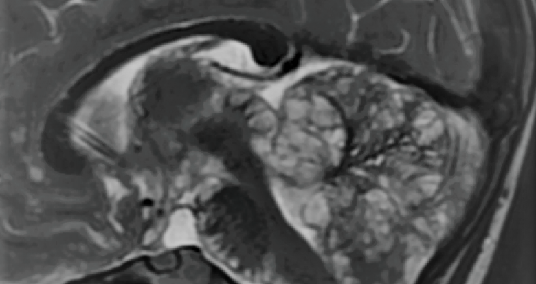 fig_1