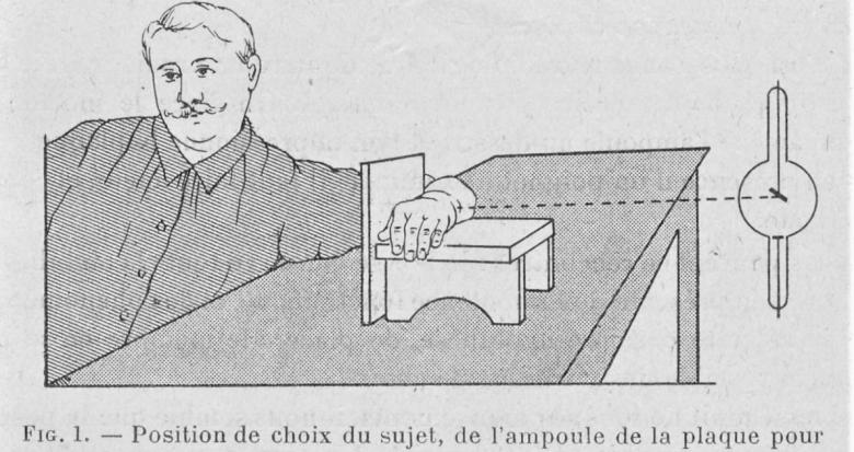 radiographie dans les traumatismes du poignet