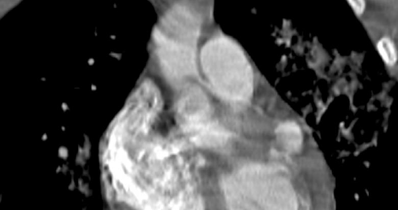 fig_1