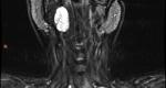 fig_1
